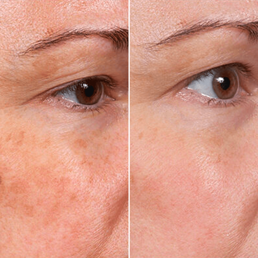NATRAVOR Face Serum